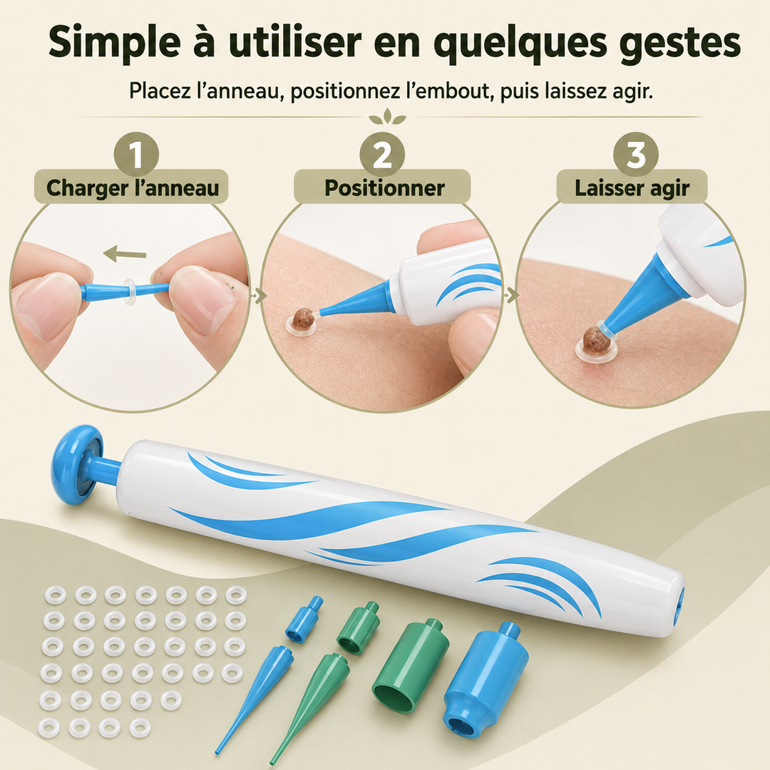 Avant/Après: peau lisse grâce au traitement DermaLinx des verrues et grains de beauté. Solution beauté.