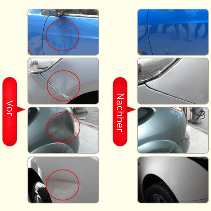 Réparez votre carrosserie avec ce kit de débosselage sans peinture. Élimine bosses et enfoncements.