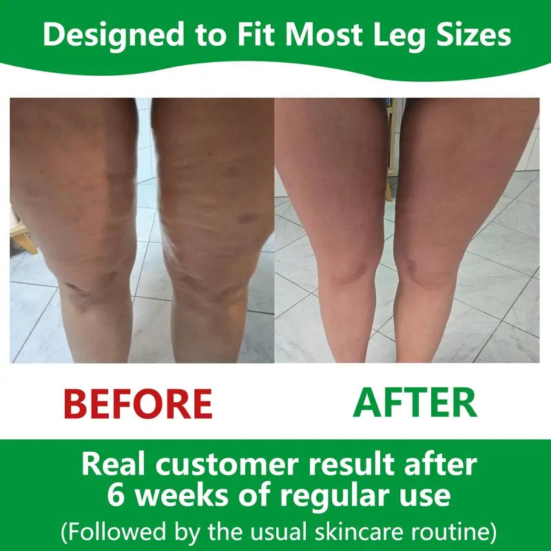 Produit de bien-être, rouleau de massage anti-cellulite, idéal pour tonifier le corps et améliorer l'élasticité de la peau.