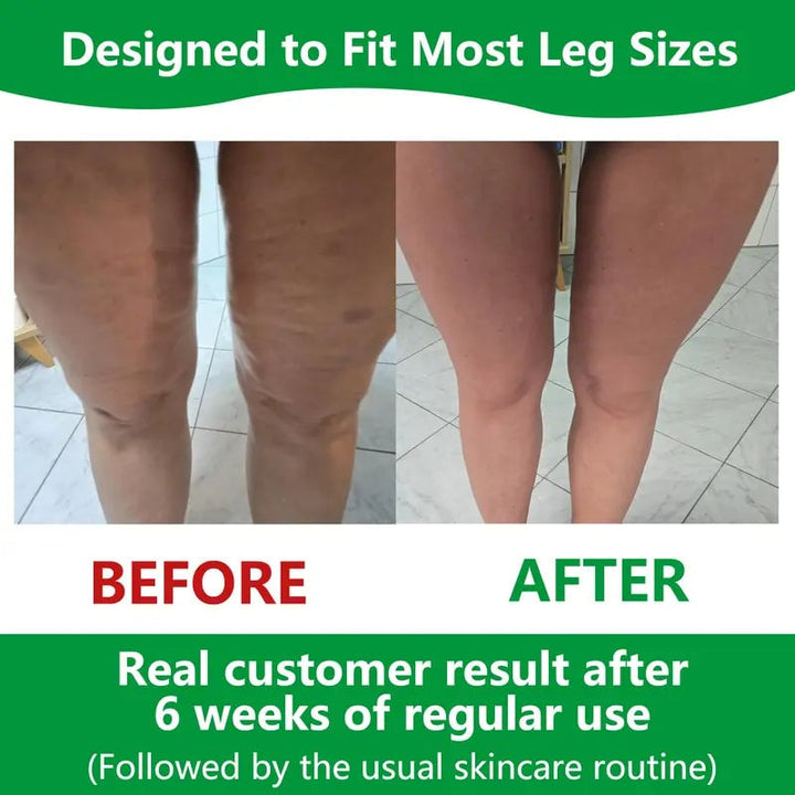 Produit de bien-être, rouleau de massage anti-cellulite, idéal pour tonifier le corps et améliorer l'élasticité de la peau.